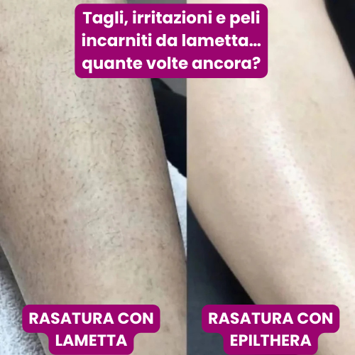 EpilThera™ – Depilatore Irelax CrystalSmooth™